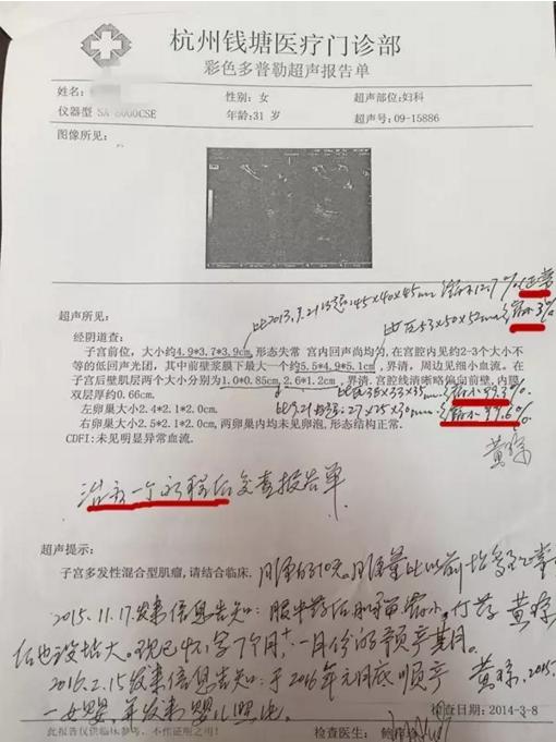 肌瘤消除方法,肌瘤消融疗法