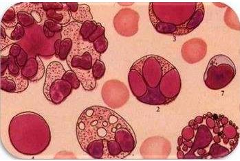 看自身免疫性疾病到哪个科室,自身免疫性疾病是先天得的吗