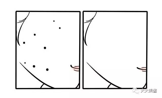 激光点痣全过程视频,激光点痣小视频