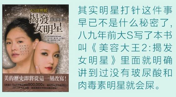 瘦脸针注射次数多了还会有效吗,瘦脸针注射多久后可以恢复自然