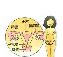 在月经期出血一定是来月经吗,经期出血和月经的区别