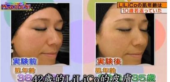 胶原蛋白肽真实实验,胶原蛋白真的这么好用吗