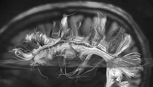 大脑思维大数据,大脑袋有没有大智慧