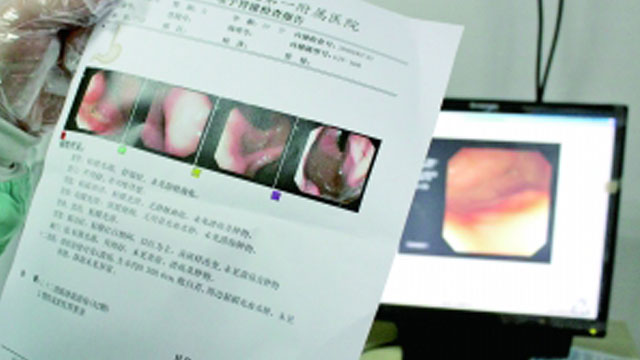 有胃炎患者胃镜多久做一次,胃炎患者建议多久做一次胃镜