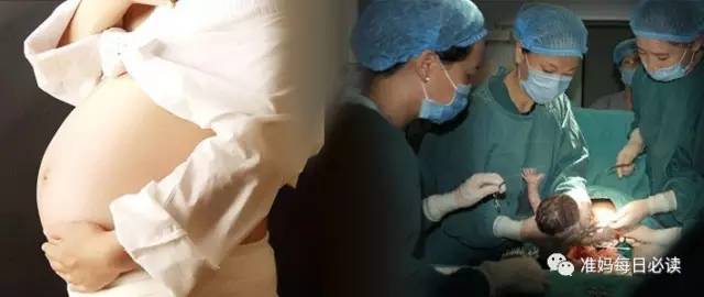剖宫产的医学指征，出现这些状况，准妈只能剖腹产了！