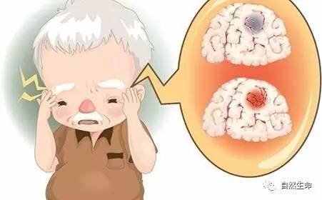 中风了和正常人不一样怎么办,中风证候分型