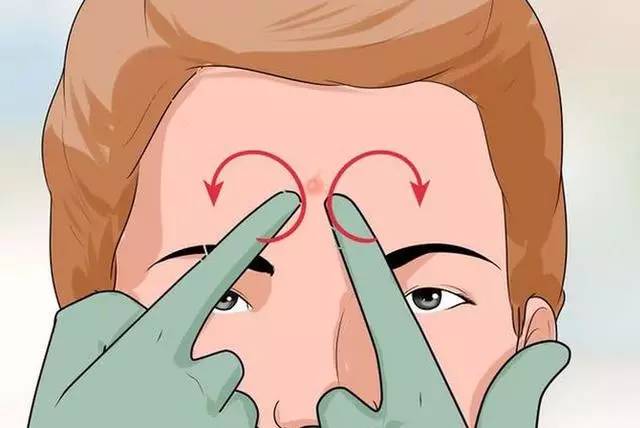 痘痘可以自己用针挤吗,痘可以挤吗