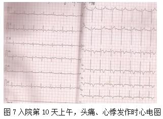 心前区疼痛、憋闷、咽部有紧缩感，伴出汗、呕吐可能是什么病？