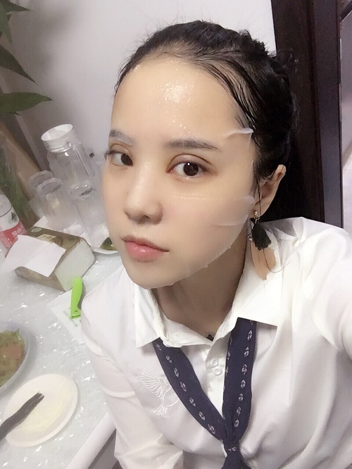 全切双眼皮疤痕增生多久可以恢复,全切双眼皮恢复过程经历真实