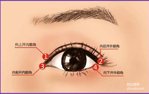 内眼角去哪里开,内眼角怎么开眼角