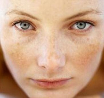 不做斑女郎的护肤品,不做斑女郎完整视频