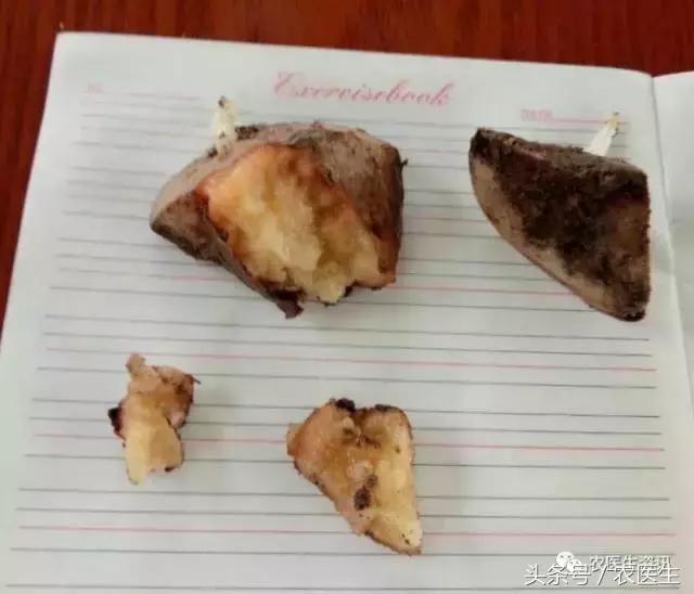 白菜被虫子咬怎么治,新种的白菜被虫咬怎么办