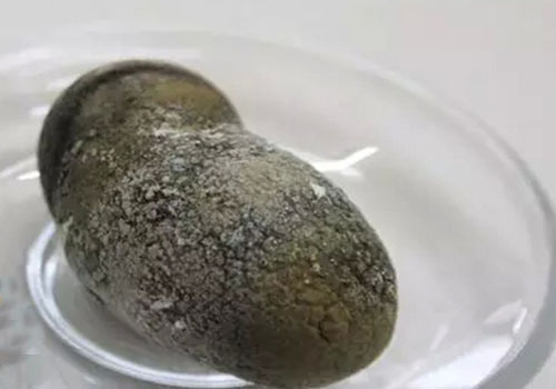 肝胆排石只喝三天的苹果汁行吗,苹果汁为什么可以排肝胆结石