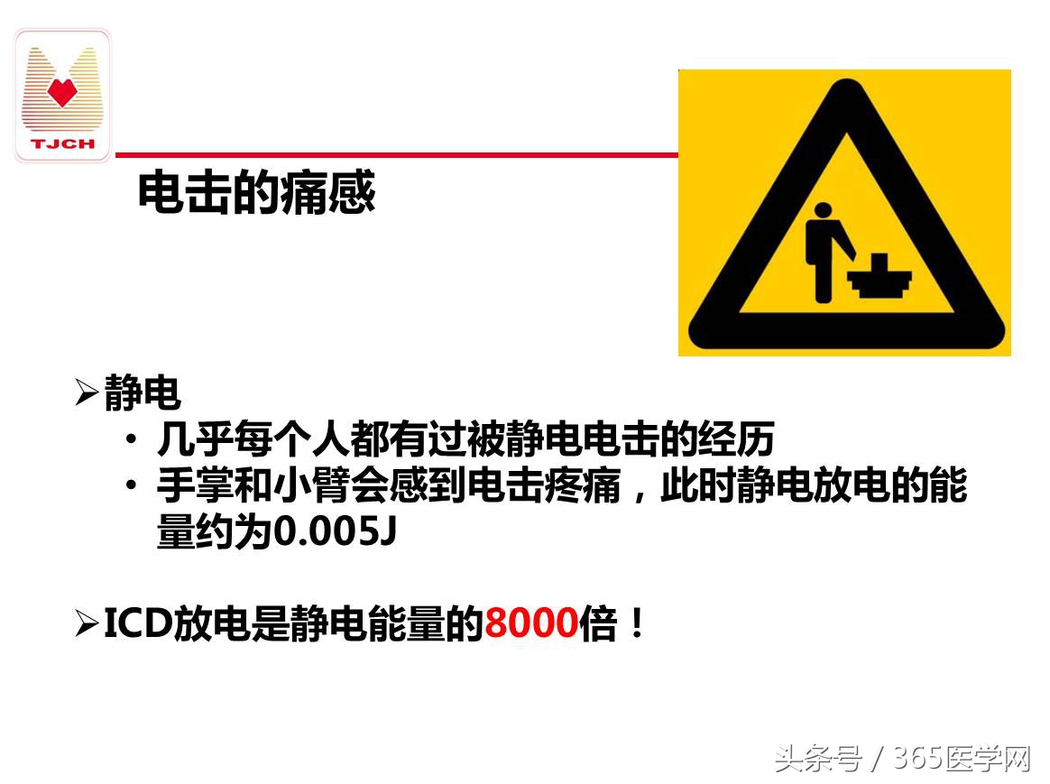 许静：新技术避免ICD不恰当放电