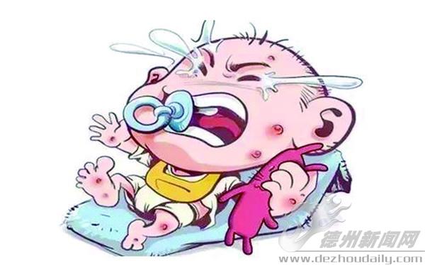 妈妈吃螃蟹引起的婴儿湿疹,宝宝湿疹母乳妈妈可以吃海鲜吗