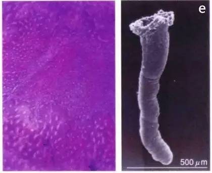 普通内镜与Pitpattern分型（多图详解）