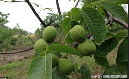 白癜风明星有哪些,白癜风明星