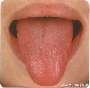 舌头舌诊,如何快速辨舌诊