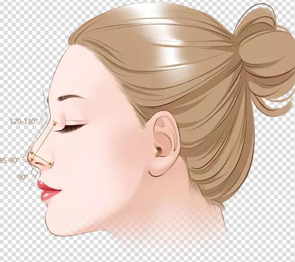 鼻部整形有哪些注意事项,鼻部整形一个月内能做剧烈运动吗