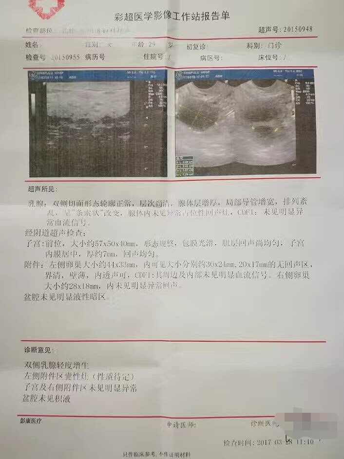 盆腔积液及巧克力囊肿治疗一则