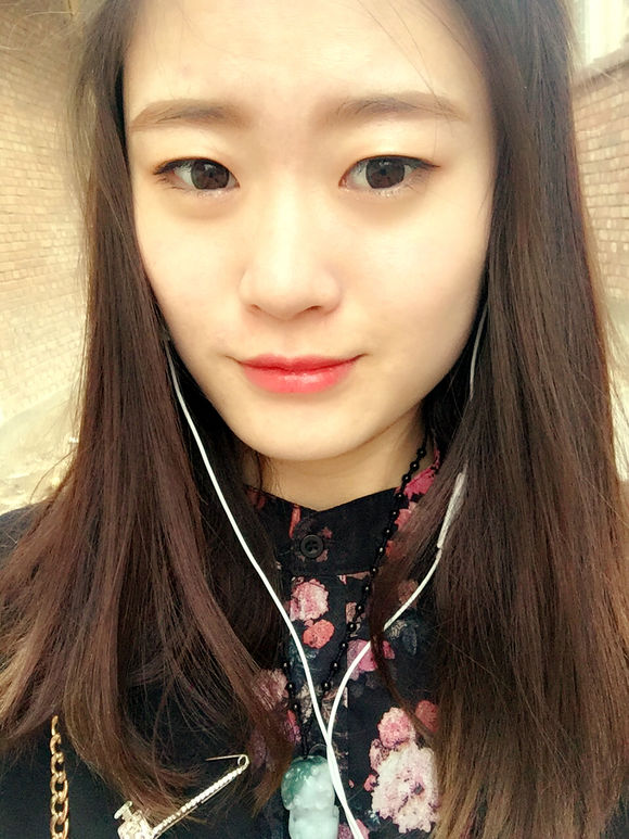 全切双眼皮一个月还是肿怎么回事,全切双眼皮一个月还肿是怎么回事