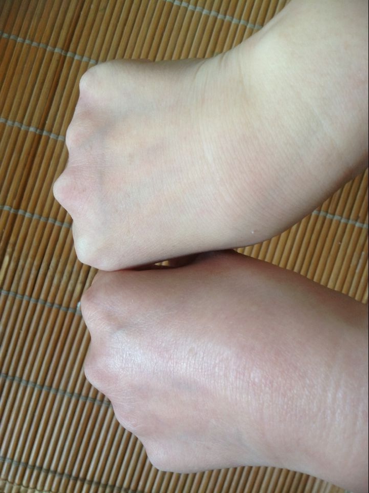 鍑濊兌闈㈣啘,鍑濊兌鑳跺師铔嬬櫧闈㈣啘