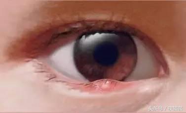 长期熬夜眼袋很严重怎么去除,熬夜怎样去除黑眼圈眼袋