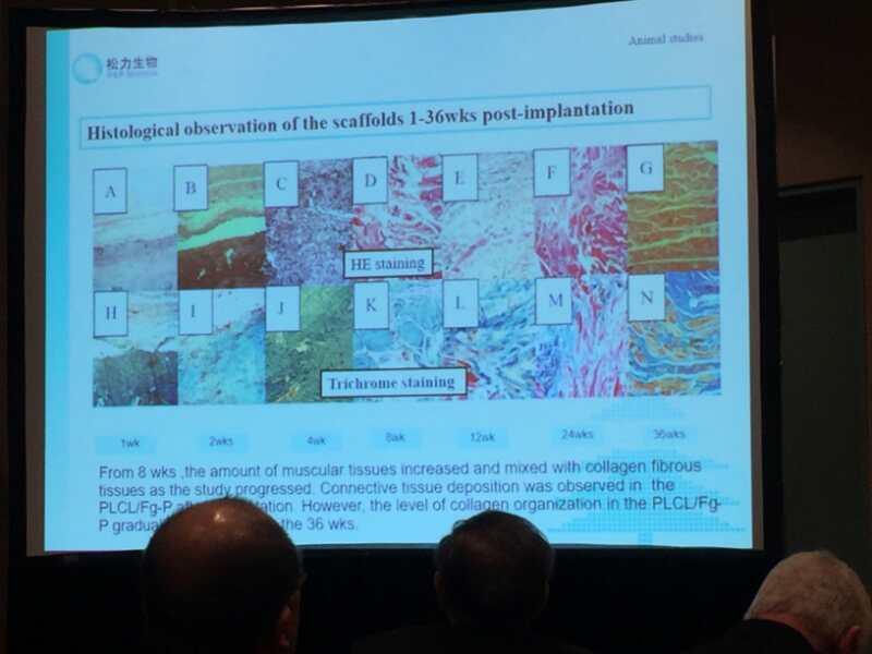 中国生物材料龙头企业开创组织修复生物材料的新纪元