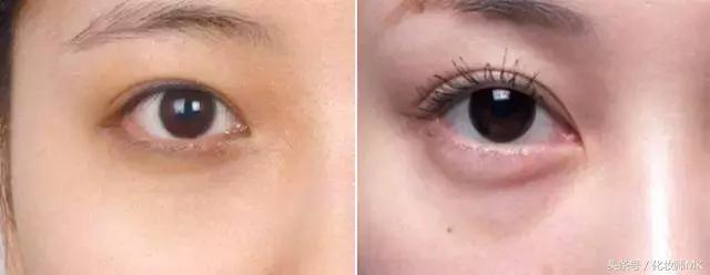 黑眼圈眼霜真的有用吗,黑眼圈眼袋用护肤品可以缓解吗