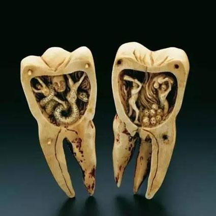 牙疼的快来看一招快速解决牙疼,牙疼不是病但是疼起来真的要人命