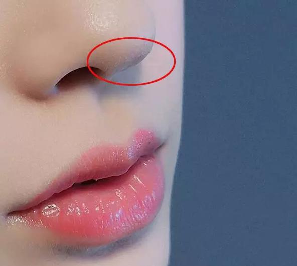 黑头会不会越清理越大呢,黑头会越积越多原因