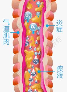 慢阻肺肺气肿的最佳治疗方法,肺气肿买什么样的呼吸锻炼仪好