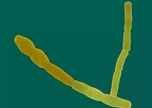 空调散热片脏了怎么回事,空调散热片污染