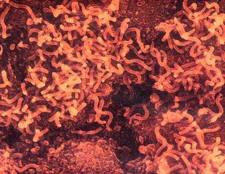 人类历史瘟疫记录,人类瘟疫灾难史