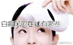 泛发性白癜风的症状有哪些特点,白癜风散发性和泛发性哪种好治疗