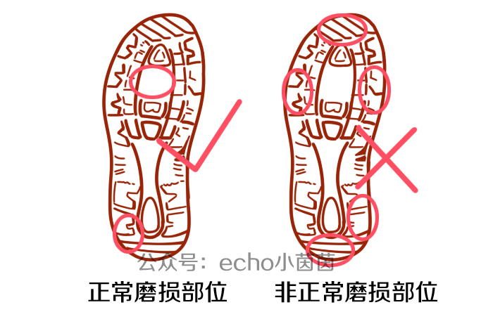 宝宝鞋底哪边磨得最厉害？背后问题没那么简单！