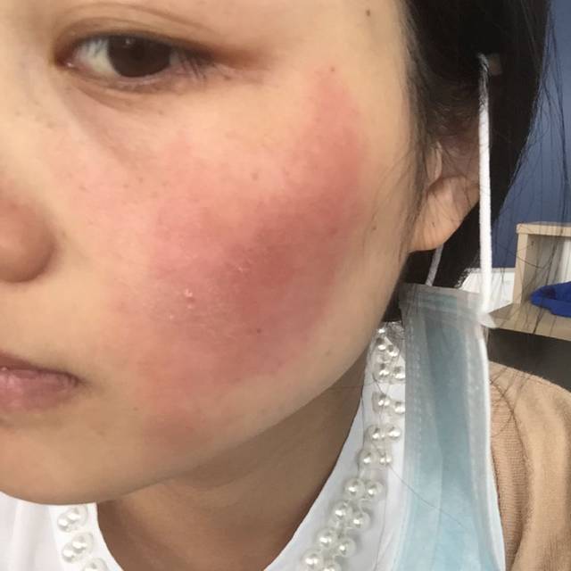 虽然可以省钱，但这4个偏方真的很伤肤