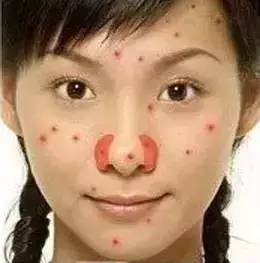 脸的侧面为什么长一些小痘痘,为什么额头上长了好多痘痘