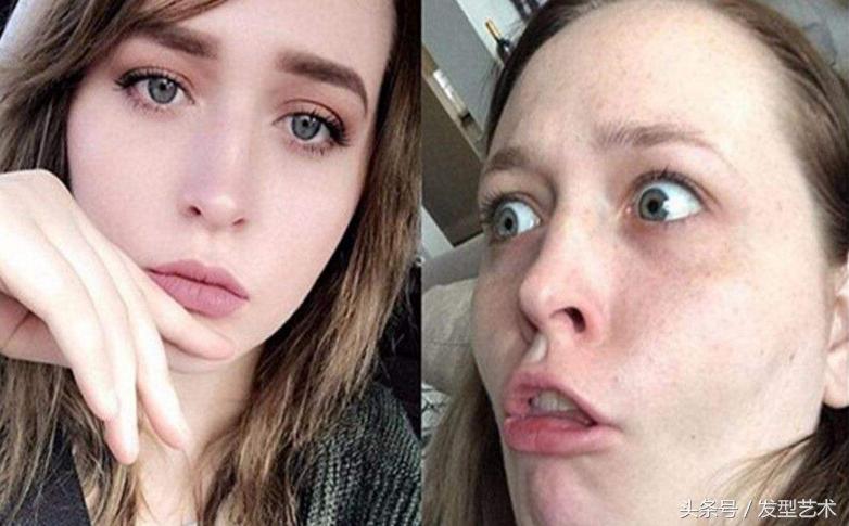 脸上毛孔粗大是什么原因引起的,皮肤粗糙暗沉毛孔粗大怎么改善