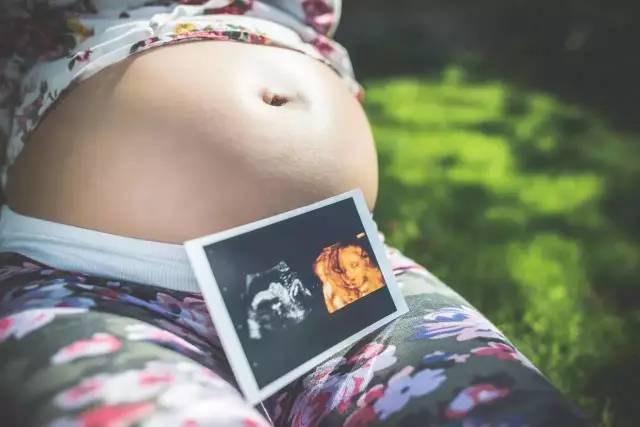 四维彩超查出胎儿不正常的指标,四维彩超看不出唐氏儿