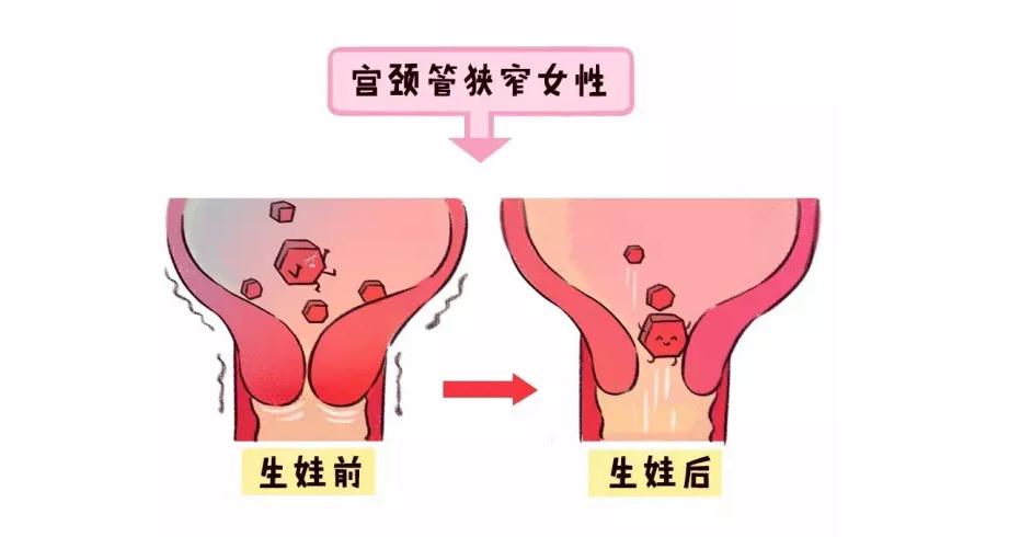 痛经是不是结婚生孩子后会好,女孩子痛经结婚生了孩子会好吗