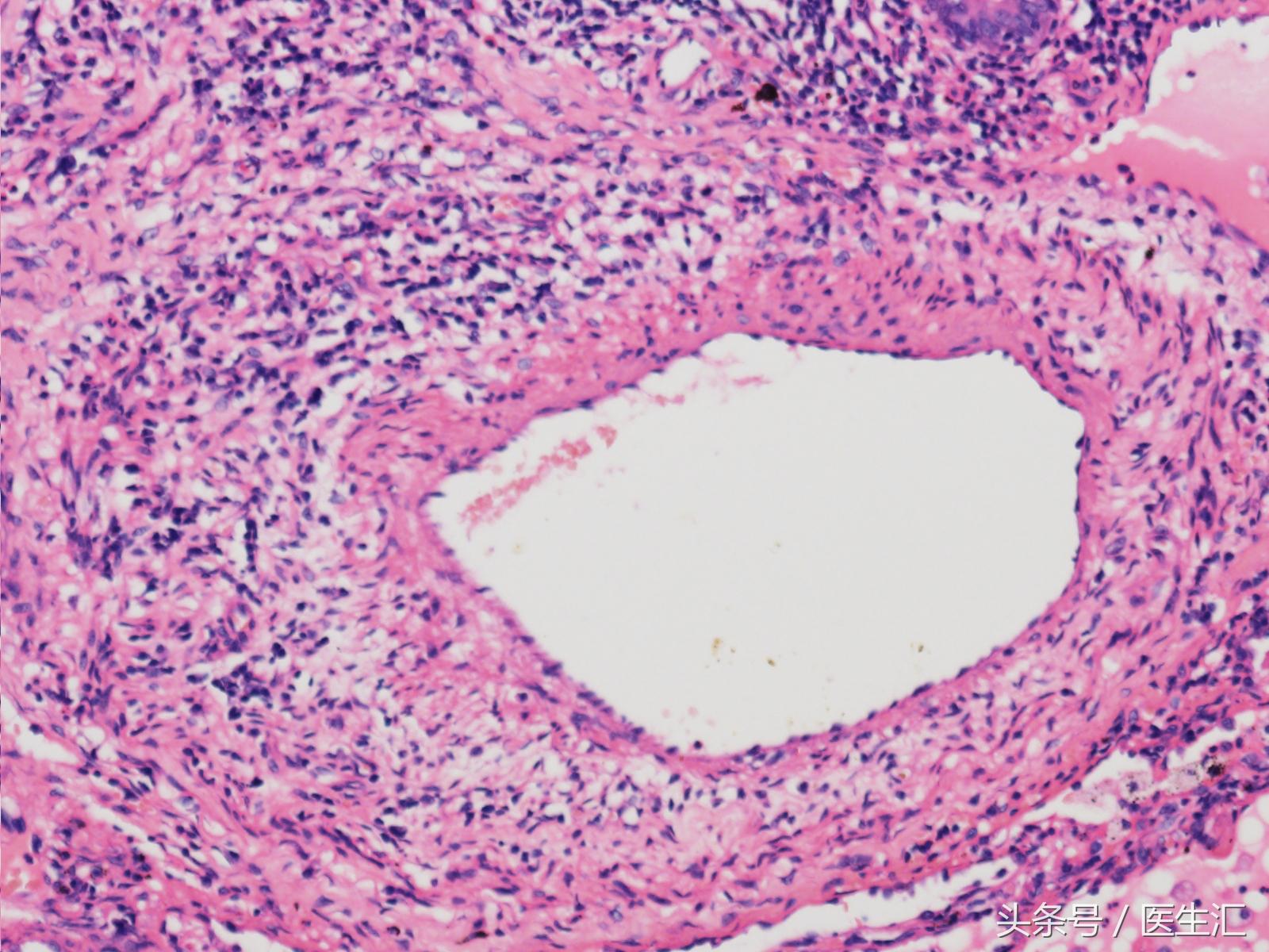 两年了老是咳嗽怎么回事,老人稍微活动气急气喘怎么办