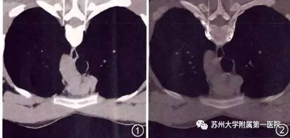 每天都汗如雨下,每天汗如雨下好不好