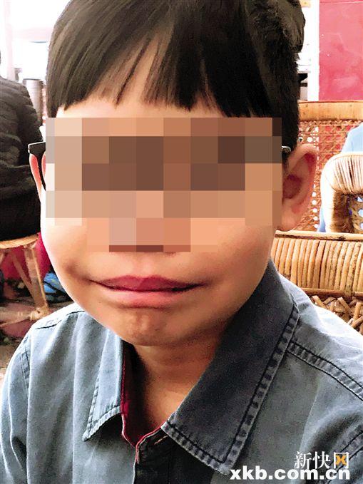 目前地贫患儿存在的困难有哪些,地贫儿童救助