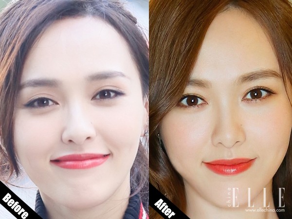 双眼皮100种整形图解,双眼皮整形全程讲解