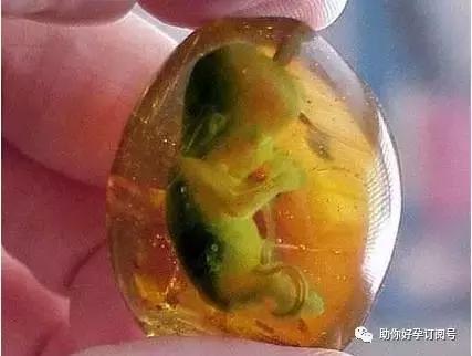 羊水是胎儿生命之水,包含太多孕育信息,你真的了解吗?