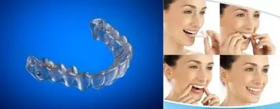 孙杨矫正牙齿前后,孙杨的牙齿是如何整形的