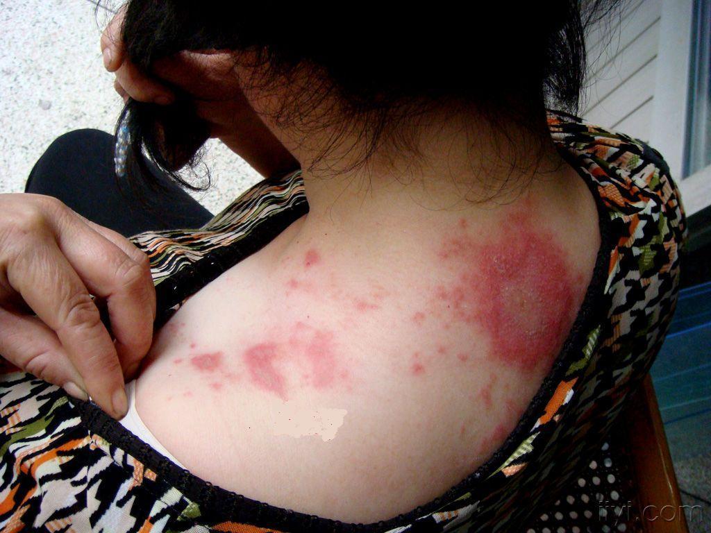 夏天来了家里的虫子好多怎么办,夏天要来了小心蚊虫