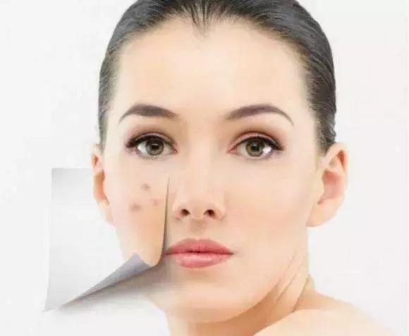 怎样卸妆才干净？卸妆不对，分分钟毁容！