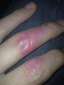 身体出现这些状态一定要注意,当身体出现这些不适就要警惕了